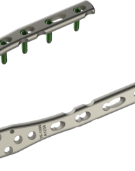 Placas de Osteosíntesis (Olecranon)